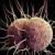 Number Of Gonorrhea Cases Increasing Outside Urban Hubs