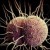 Number Of Gonorrhea Cases Increasing Outside Urban Hubs
